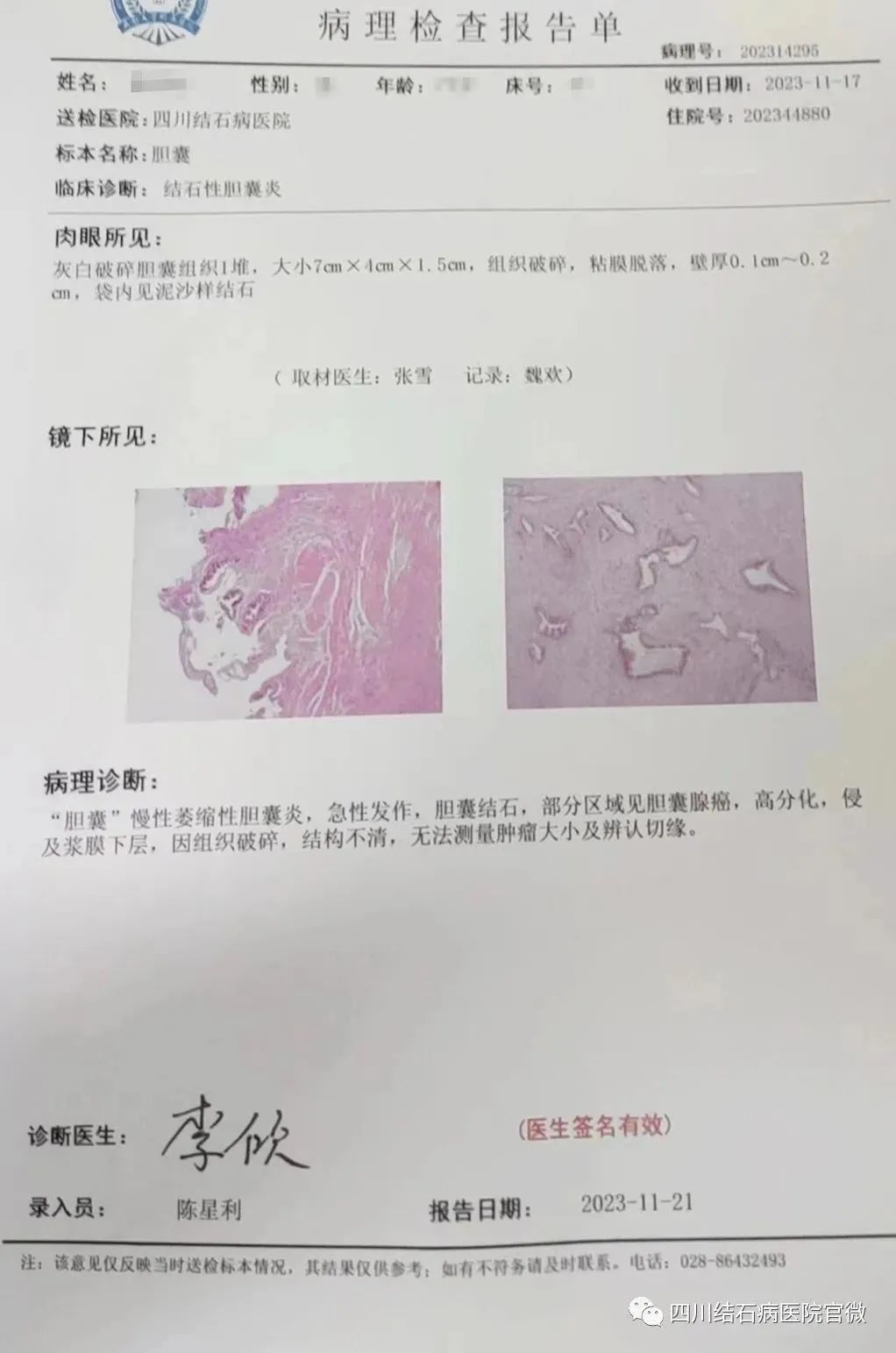胆结石拖一拖无所谓?四川保胆取石专家:那是你没见识到它的“杀伤力”(图1) 胆结石拖一拖无所谓?四川保胆取石专家:那是你没见识到它的“杀伤力”(图1)