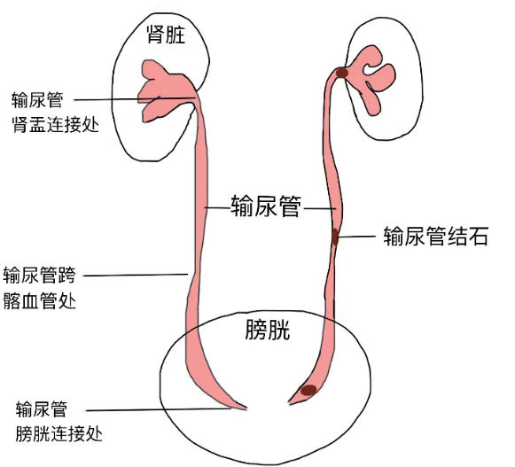 成都肾结石医院揭秘:肾结石四大常见误区 快来看看你中招了吗?(图3) 成都肾结石医院揭秘:肾结石四大常见误区 快来看看你中招了吗?(图3)