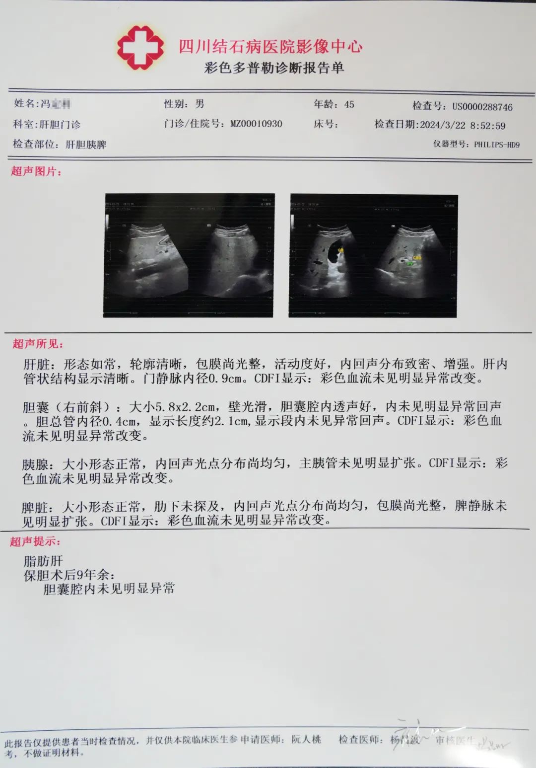 成都胆结石医院：保胆9年，他说医生的技术水平好，术后我一切正常(图1)