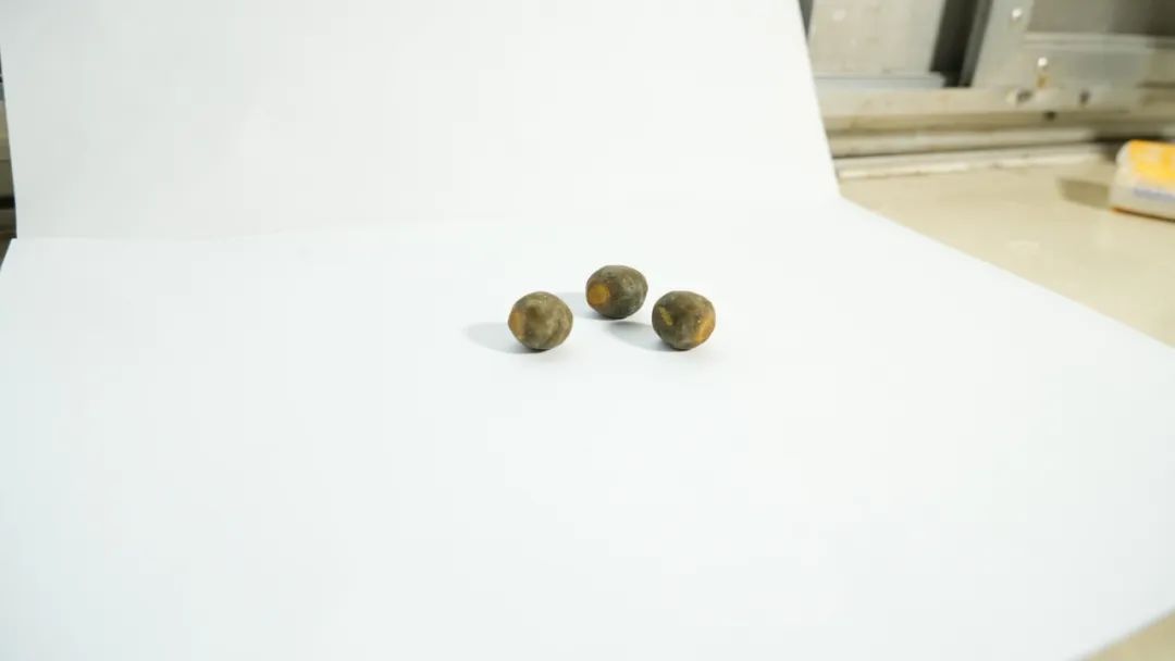 四川保胆案例：巴中姐妹同患胆结石，先后来蓉圆梦“保胆”(图3)