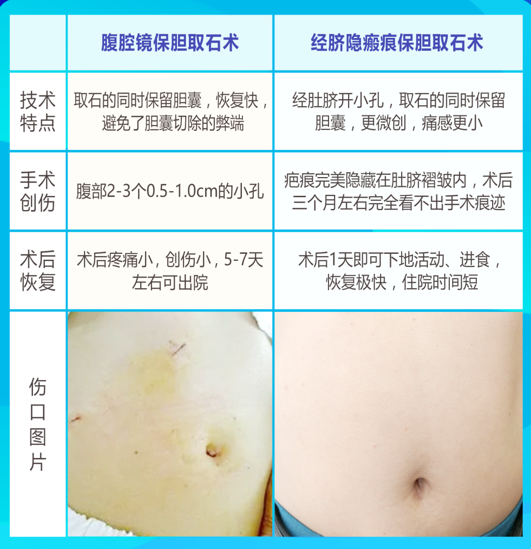 探访直击：四川结石病医院“隐形保胆”技术！「全国保胆取石基地」(图2)