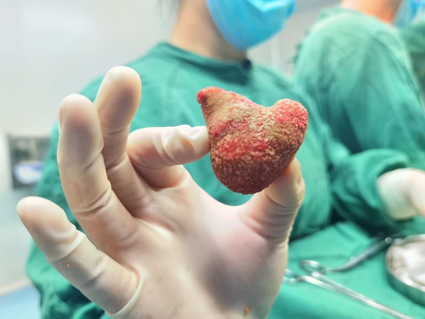 患者关注：肾结石手术痛苦吗？泌尿外科专家为你揭秘真相【成都结石病医院 | 成都肾结石医院】(图2)