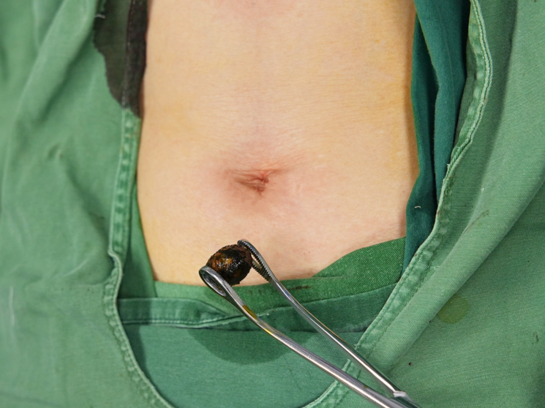 他们的五一，用坚守铸就劳动荣光【四川结石病医院】(图4)