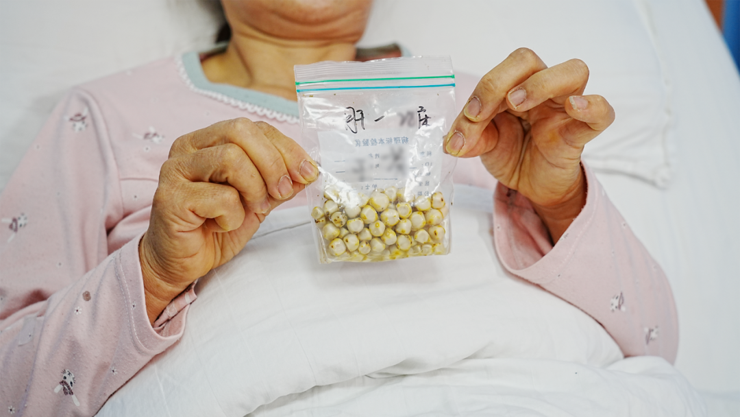 四川眉山女子毫无感觉，胆囊里竟疯长出108颗“好汉结石”【四川保胆取石最好的医院排名】(图2)