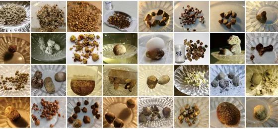 四川结石病医院是正规医院吗？收费贵吗？【四川结石病医院简介】(图3)