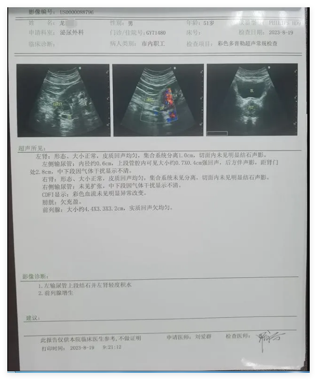 腰痛+排尿难？51岁男子双病同治，瑞梦消融术+软镜取石一次解决【成都瑞梦诊疗中心】(图2)