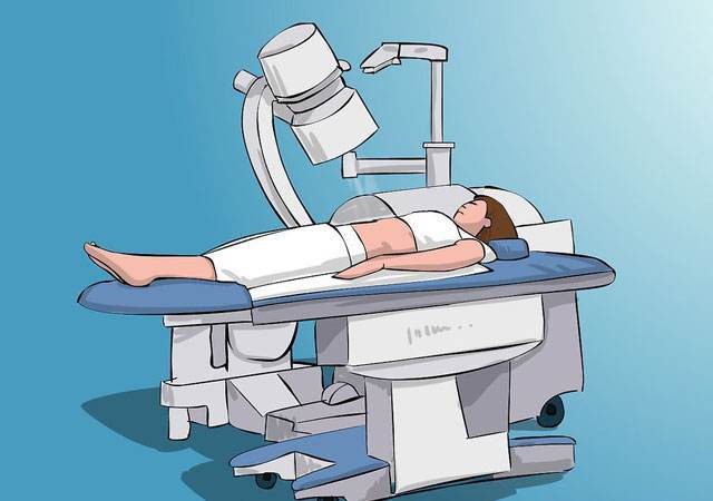 体外冲击波碎石对肾脏有多大损伤？一文读懂治疗风险与应对方案！【成都24小时碎石医院】(图2)