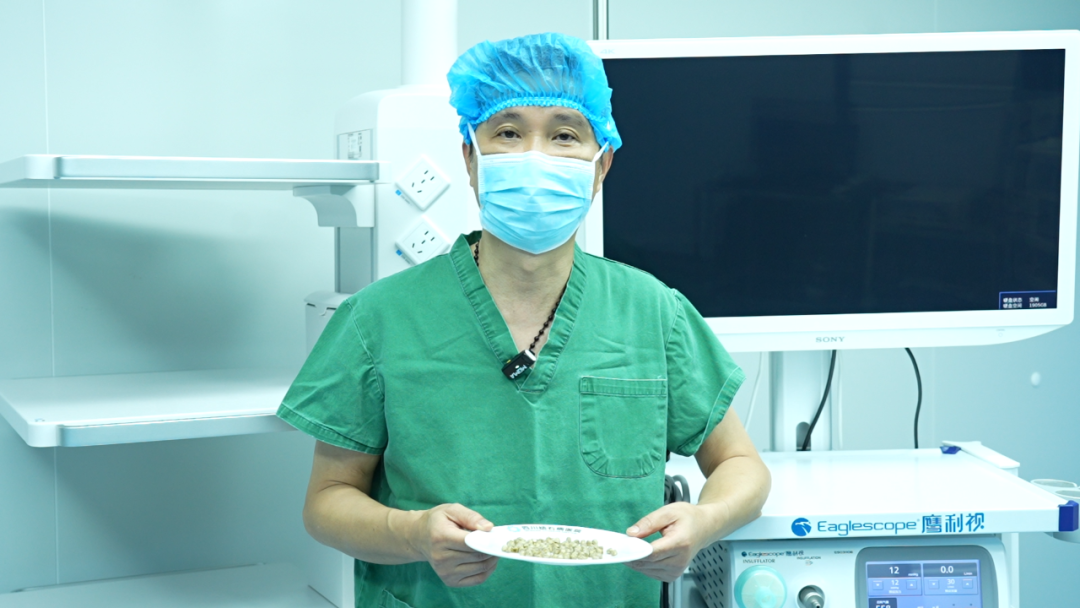 四川保胆案例分享：七年无感却藏126颗结石！男子胆囊惊现“珍珠串”(图4)