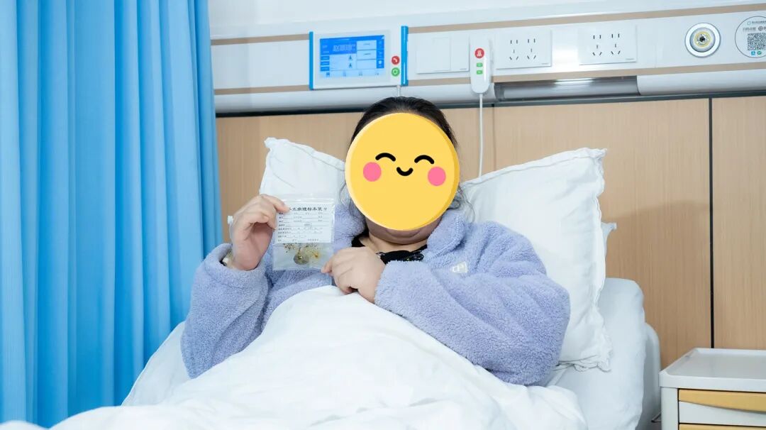 奔波求医路：广元大姐专程来蓉保胆，取出“皮蛋”状结石【四川保胆取石医院】(图2)